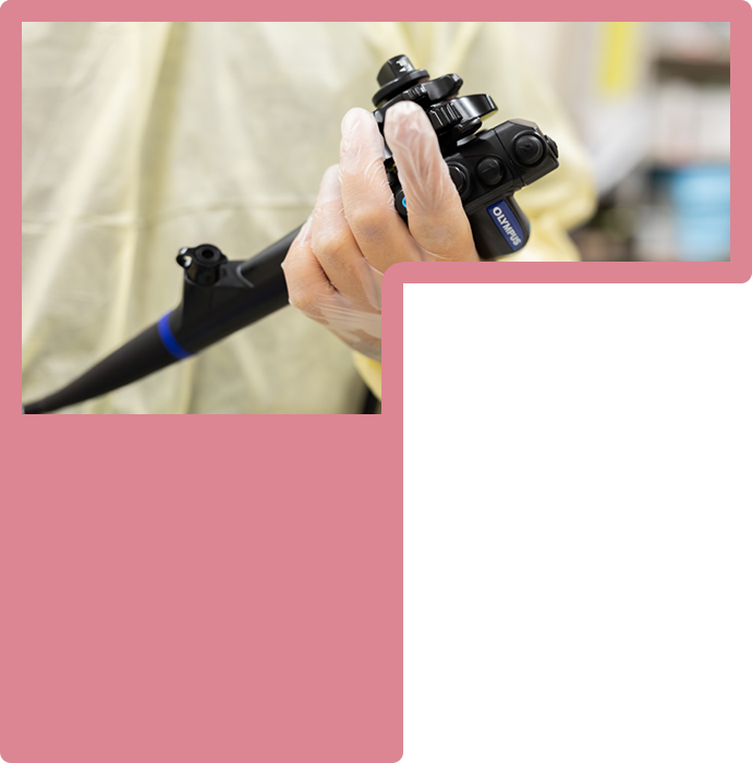 胃カメラ検査