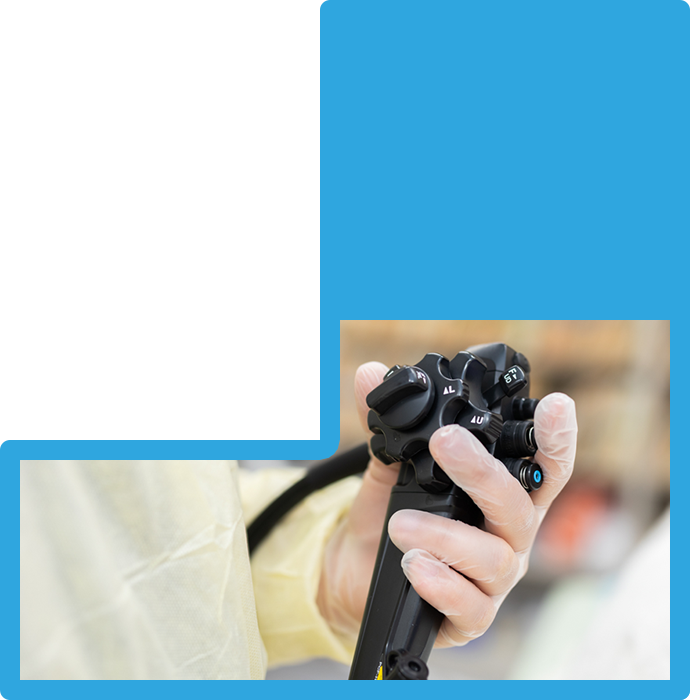 大腸カメラ検査